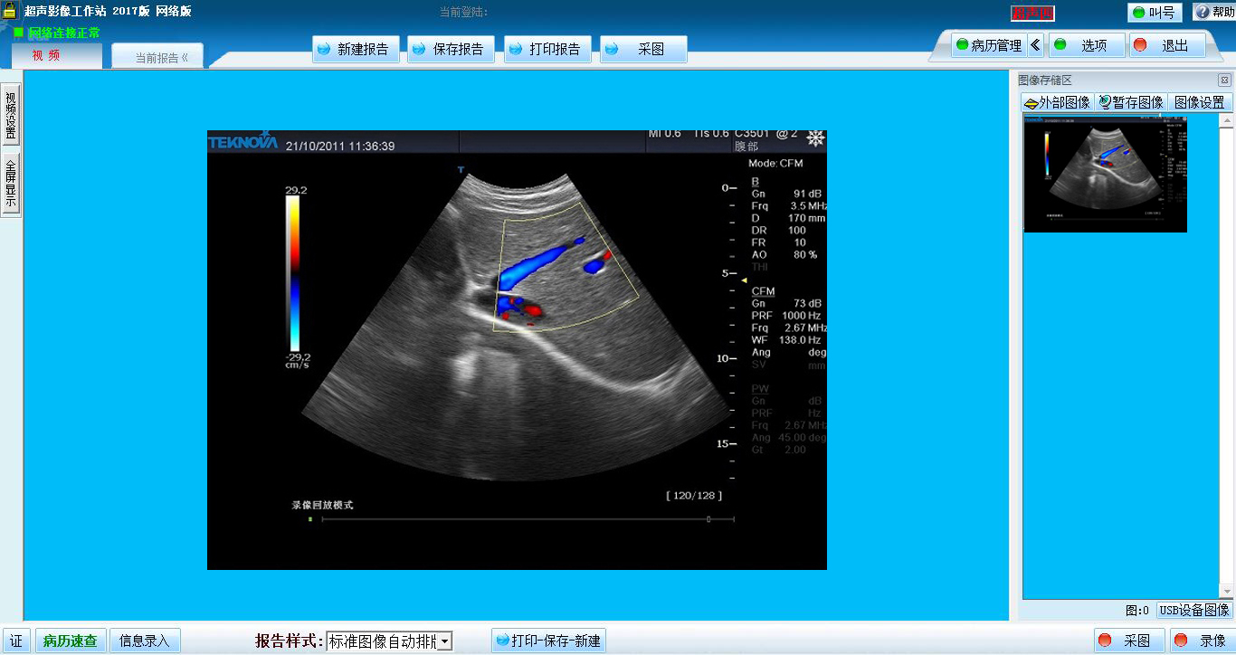 巨渺超聲影像工作站網(wǎng)絡(luò)系統(tǒng)